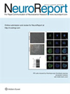 点击查看Neuroreport