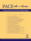 点击查看Pace-pacing And Clinical Electrophysiology