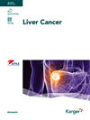 点击查看Liver Cancer