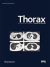 点击查看Thorax